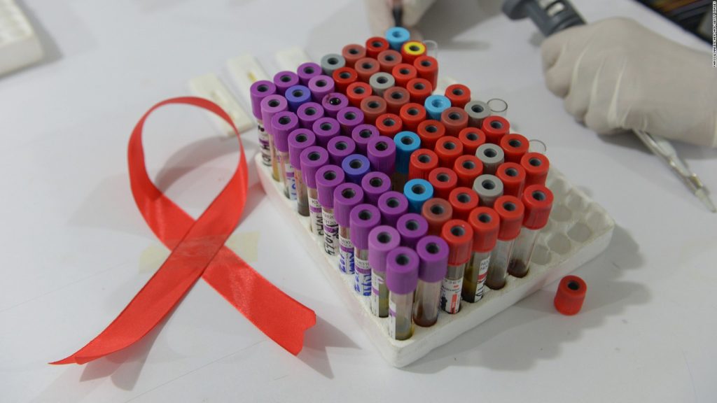 Test HIV dan Aids