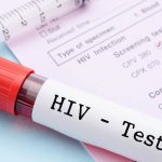 Apakah HIV dan AIDS Bisa di Obati?