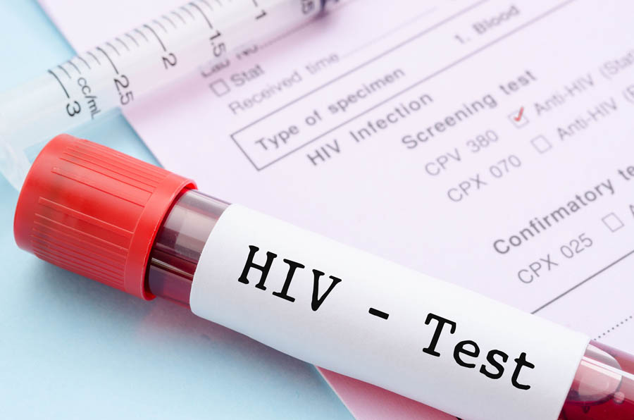 Apakah HIV dan AIDS Bisa di Obati?