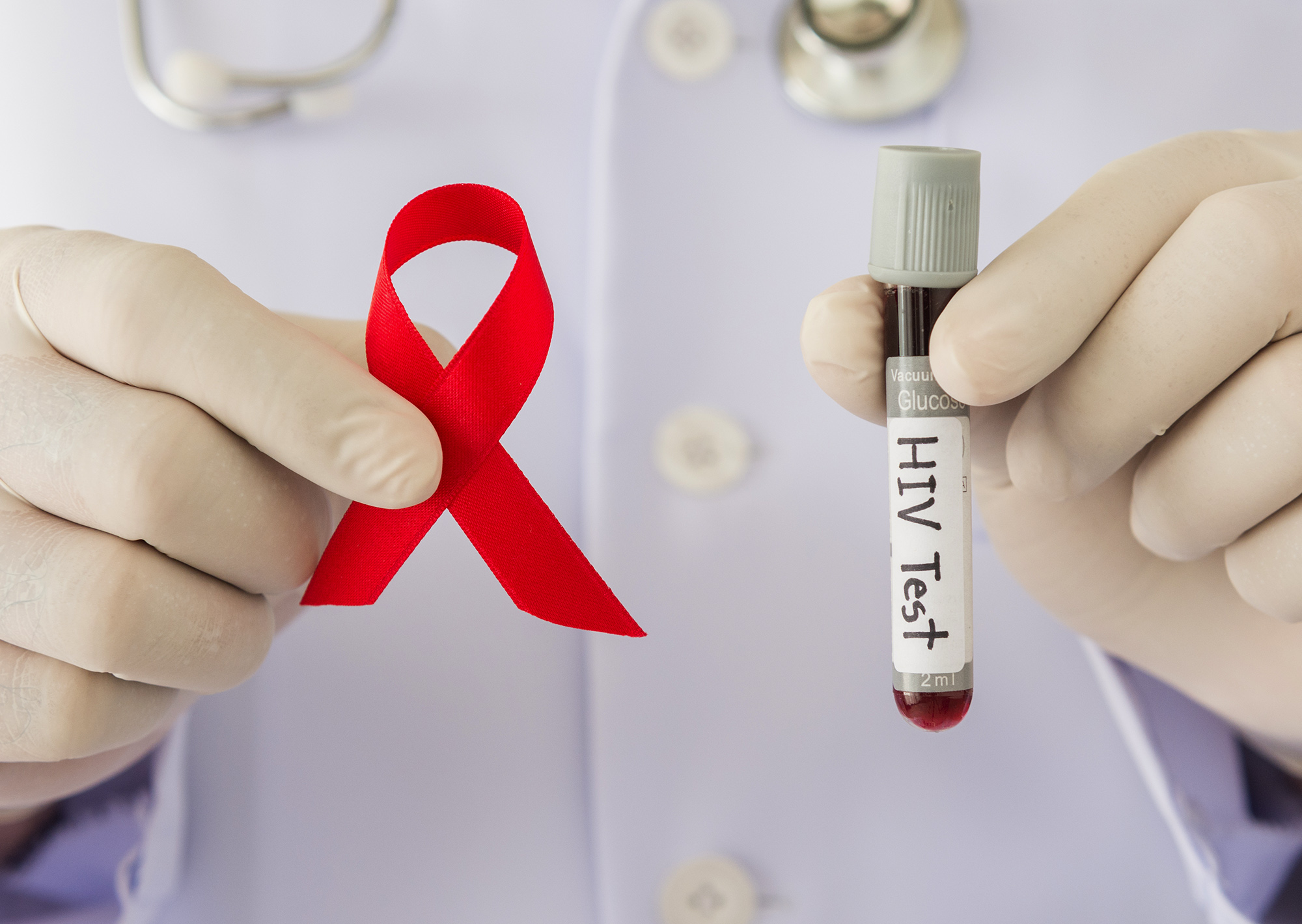 Daftar Lokasi untuk Tes HIV AIDS di Wilayah Jawa Timur