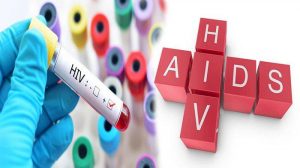 4 Informasi Penting untuk Membuat Anda Lebih Paham tentang HIV